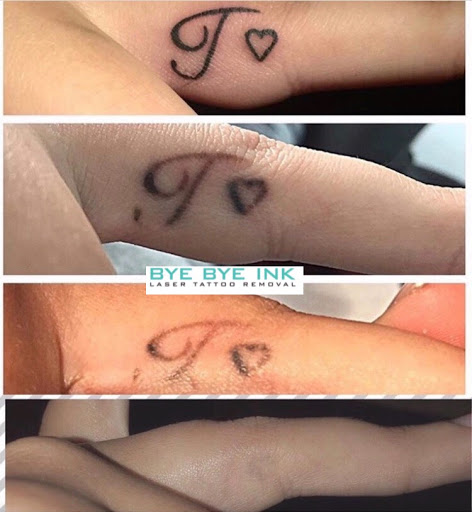 Explore photographer tattoo ideas, creative tattoo ideas in Middle Village, available at Bye Bye Ink Laser Tattoo Removal