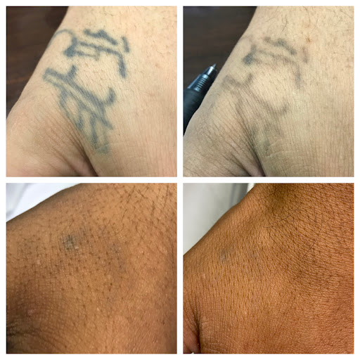 Explore honeybee tattoo ideas, creative tattoo ideas in Allen, available at Shipers Laser Tattoo Removal Center Dallas