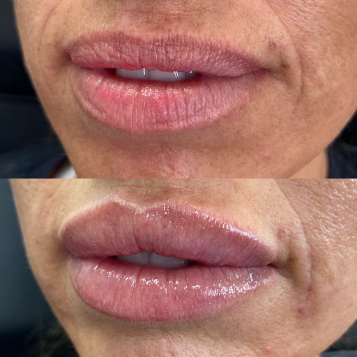 Explore star tattoo cover up ideas, creative tattoo ideas in Canton, available at JDV Med Spa