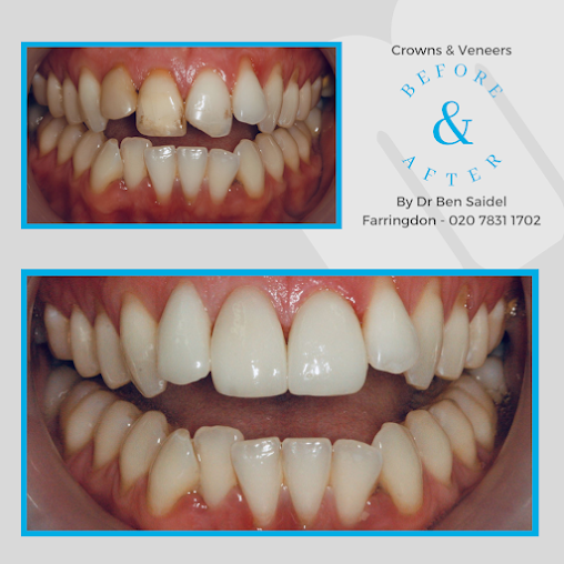 مالمين لطب الأسنان - ليفربول - Malmin Dental - Liverpool