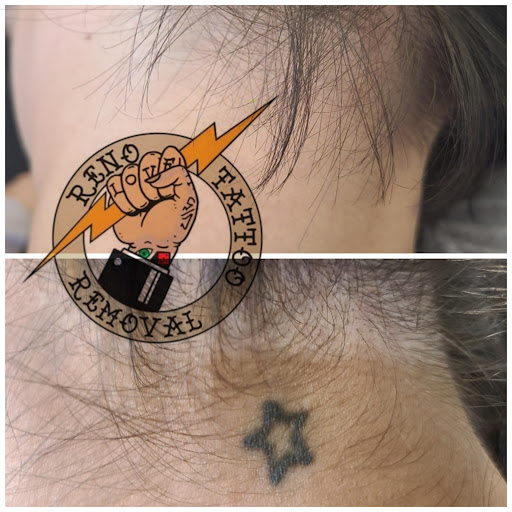 Explore oak tree tattoo ideas, creative tattoo ideas in Reno, available at Reno Tattoo Removal