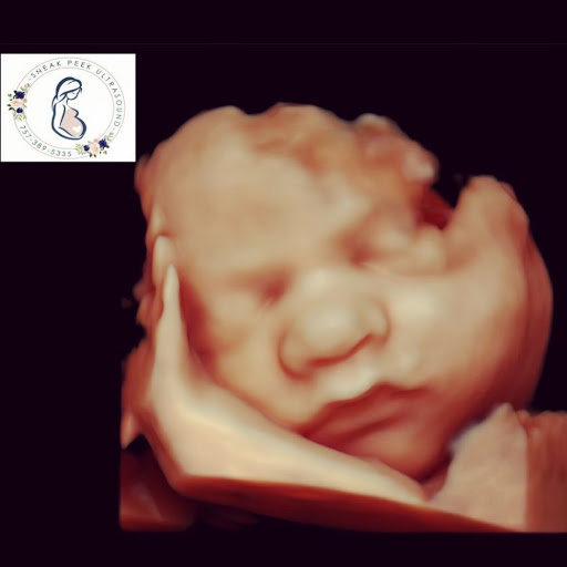 5d ultrasounds in Virginia Beach