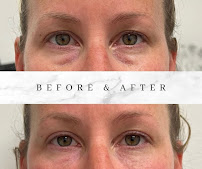 Essential Beauty Medical Spa & Laser Center - Photo 6 - Car repair in Lake Forest, CA, Mission Viejo