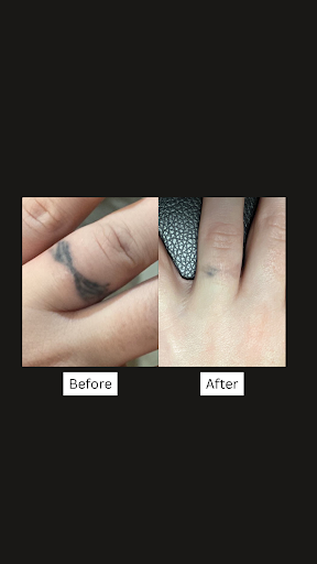 Explore sister and brother tattoo ideas, creative tattoo ideas in San Antonio, available at San Antonio Tattoo Removal Co.