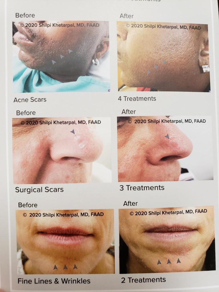 Eastside Dermatology 48236