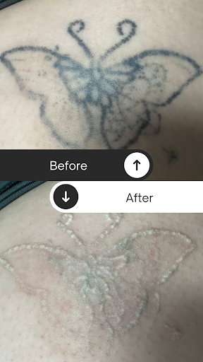 Explore valkyrie tattoo ideas, creative tattoo ideas in Mckinney, available at Premier Tattoo Removal