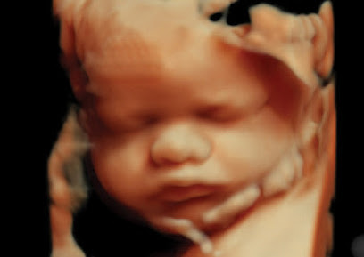 In The Womb View- 3D/4D Ultrasound
