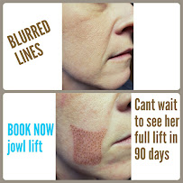 BLURRED LINES SKIN TIGHTENING - Photo 9 - Car repair in Saginaw, MI, Saginaw