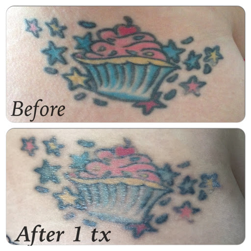 Explore angel devil tattoo ideas, creative tattoo ideas in Erie, available at Erie Laser Professionals