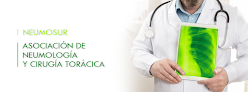 Best Sarcoidosis Specialists Seville Near You