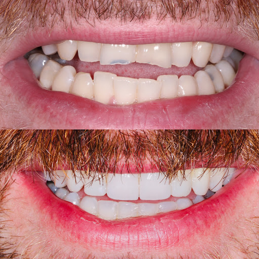 ONeill Dental Care in Swords, Co. Dublin (Baile Átha Cliath)