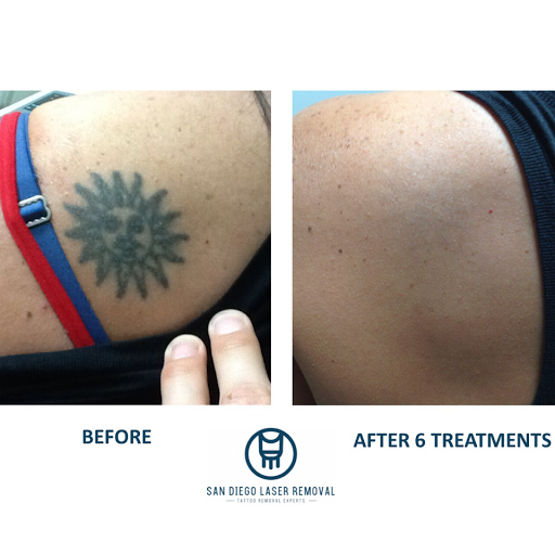 Explore tattoo ideas script, creative tattoo ideas in San Diego, available at Removery Tattoo Removal & Fading