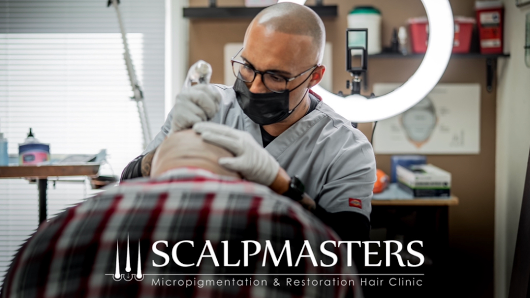 Scalpmasters - Scalp Micropigmentation Hair Clinic