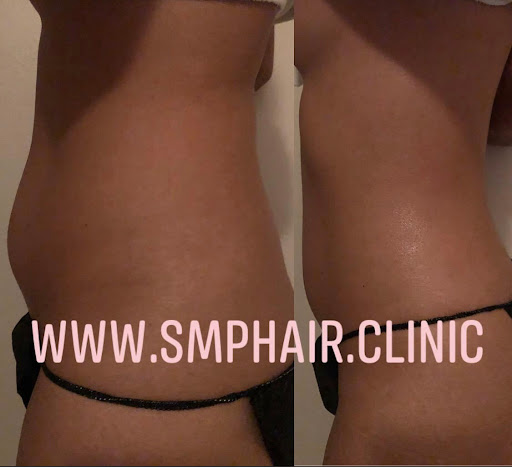 SMP Hair Clinic The Queen Of Scalp image