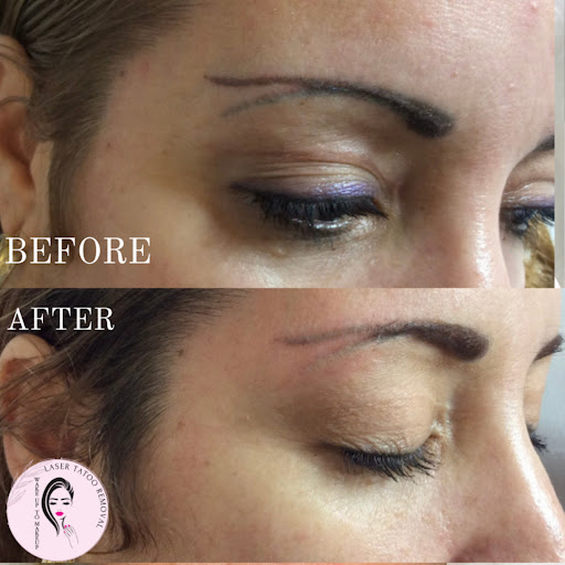 Explore all seeing eye tattoo ideas, creative tattoo ideas in Naples, available at Laser Tattoo Removal Services