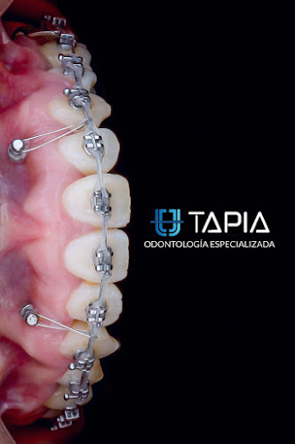 Clínica Dental Tapia - Dentista