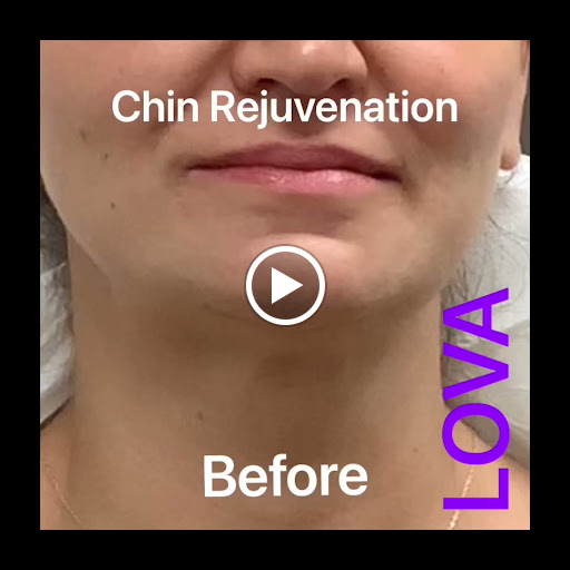 Explore tattoo ideas on collar bone, creative tattoo ideas in Lake Oswego, available at Lake Oswego Vein and Aesthetic LOVA