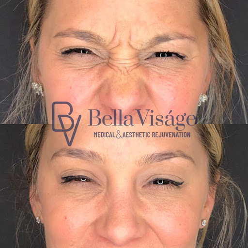 Explore butterfly tattoo ideas on arm, creative tattoo ideas in Lakeland, available at Bella Visge Medical & Aesthetic Rejuvenation