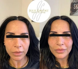 جولي جوديت - Julie Gaudet