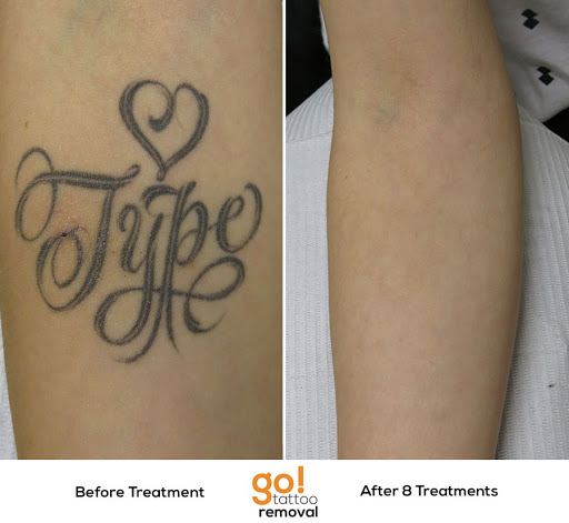 Explore sarah j maas tattoo ideas, creative tattoo ideas in Allentown, available at Removery Tattoo Removal & Fading