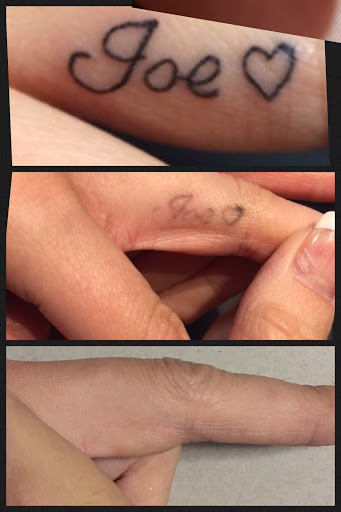 Explore tattoo name ideas for men, creative tattoo ideas in Middle Village, available at Bye Bye Ink Laser Tattoo Removal