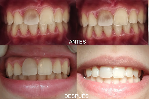 Clínica Dental Ayala - Calle Ayala, 22, 4º3, 29002 Málaga