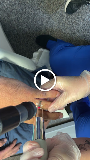 Explore lymphoma cancer tattoo ideas, creative tattoo ideas in Port Charlotte, available at Envision Laser Removal