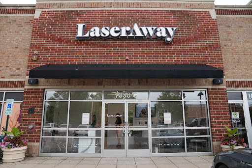 Explore halloween theme tattoo ideas, creative tattoo ideas in Northbrook, available at LaserAway