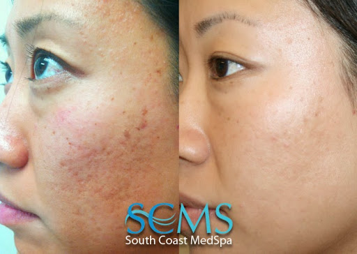South Coast MedSpa image