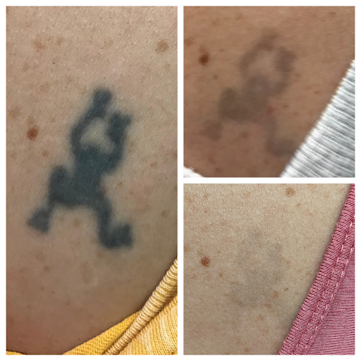 Explore god tattoo ideas for men, creative tattoo ideas in Allen, available at Shipers Laser Tattoo Removal Center Dallas