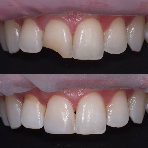 Mission Dental - Best Dental Office in Yorba Linda, Placentia, Anaheim and Fullerton CA image