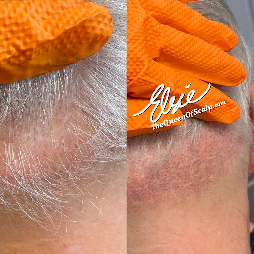 SMP Hair Clinic The Queen Of Scalp image