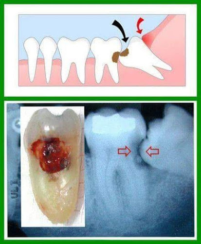 Bustamante Salud Dental - Consultorio Odontologico - Dentista
