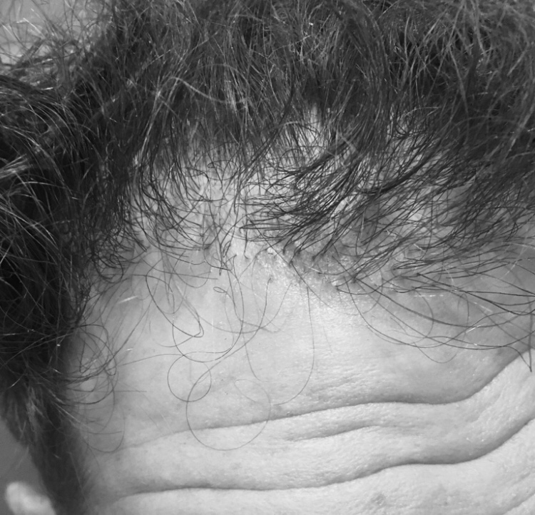 Shear Pointe Hair Restoration Center