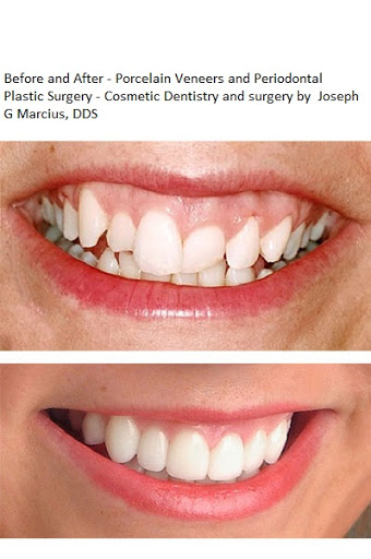 Chapel Hill Dental Care - Joseph G. Marcius, DDS