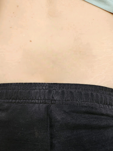 Explore ecuadorian tattoo ideas, creative tattoo ideas in Cumming, available at Atlanta Tattoo Removal