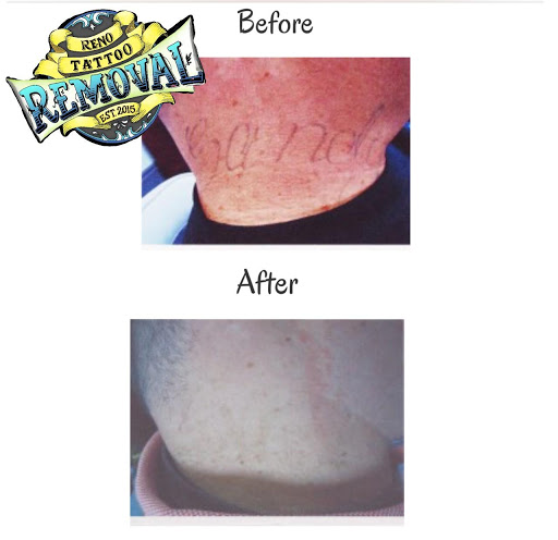 Explore grandbaby tattoo ideas, creative tattoo ideas in Reno, available at Reno Tattoo Removal