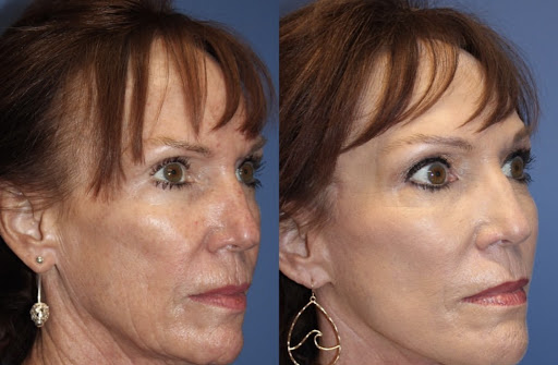 Medical Spa «Lavender Med Spa», reviews and photos, 3675 Crestwood Pkwy #400, Duluth, GA 30096, USA