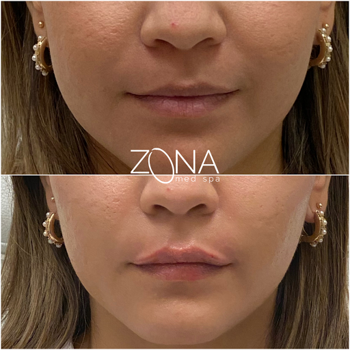 Skin Care Clinic «ZONA MED SPA», reviews and photos, 9767 N 91st St #102, Scottsdale, AZ 85258, USA