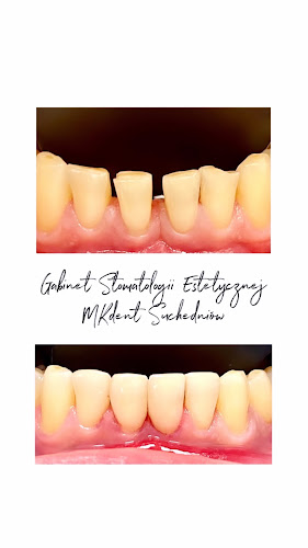 Gabinet Stomatologii Estetycznej MKdent - Stomatolog
