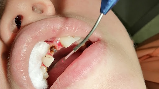 Clini-Dental