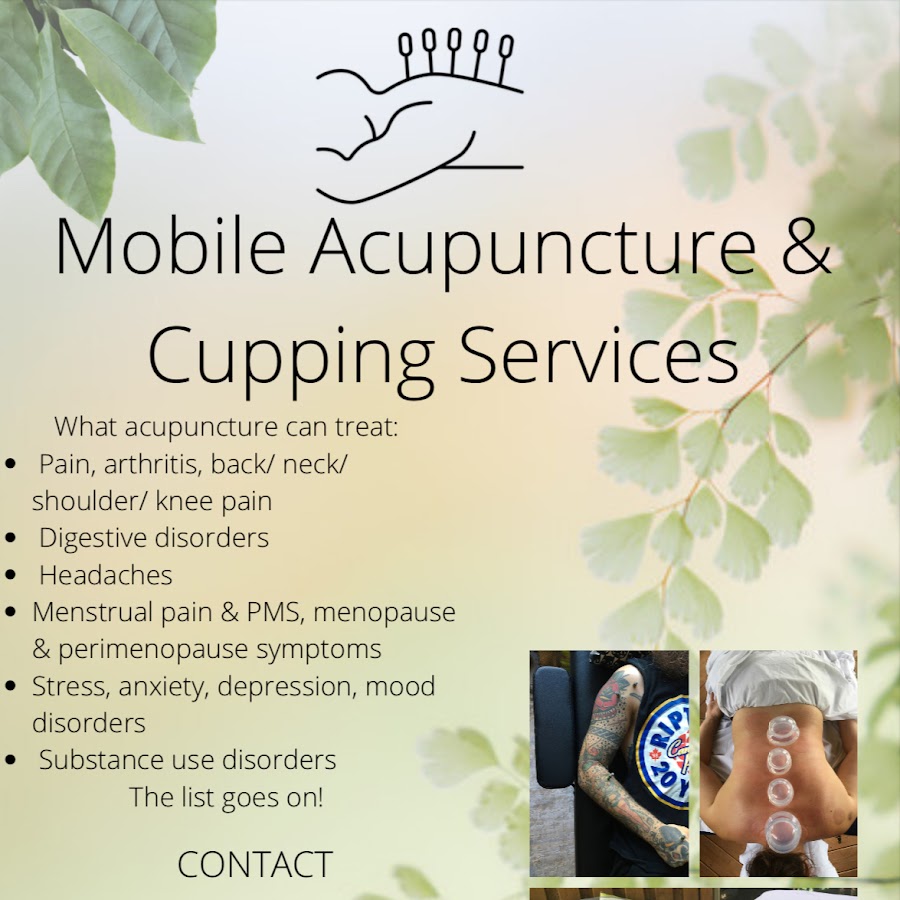 Trade Up Acupuncture