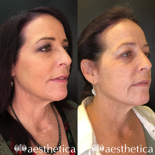 Explore camera tattoo ideas, creative tattoo ideas in Pleasant Grove, available at Aesthetica