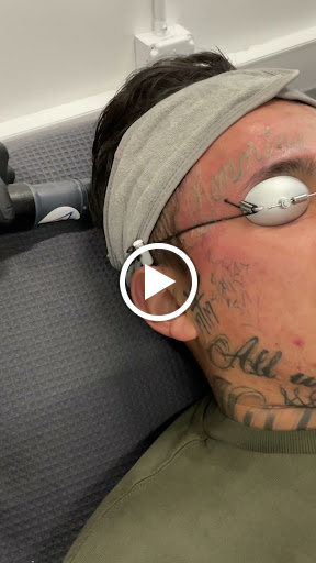 Explore beach tattoo ideas, creative tattoo ideas in New York, available at Ag2g Laser Tattoo Removal & MedSpa