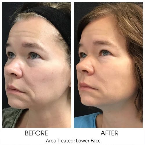 Explore tattoos behind ear ideas, creative tattoo ideas in York, available at Lbo Aesthetics & Spa - York, PA