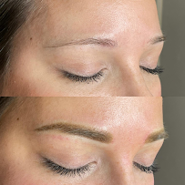 Flawless Glo MedSpa - Photo 8 - Car repair in Grand Junction, CO, Grand Junction