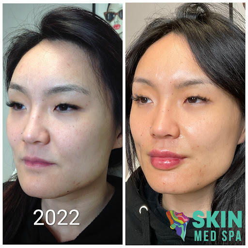 Explore 3 letter tattoo ideas, creative tattoo ideas in Downers Grove, available at Skin Med Spa