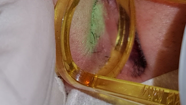 Opinii despre עינת לייזר קנדלה - Einat Candela Laser în ירושלים - מכון יופי