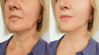 Capri Facials Glendale - Photo 9 - Car repair in Glendale, CA, Glendale