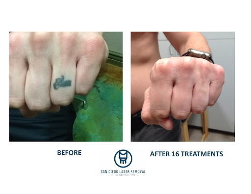 Explore scenic tattoo ideas, creative tattoo ideas in San Diego, available at Removery Tattoo Removal & Fading